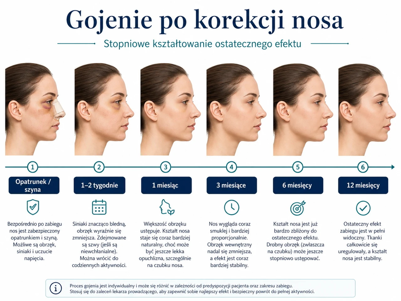 Plansza medyczna: etapy gojenia po korekcji nosa od opatrunku do ostatecznego efektu.